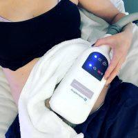 Typically, A CoolSculpting Treatment Area Is About The Size Of The Hand